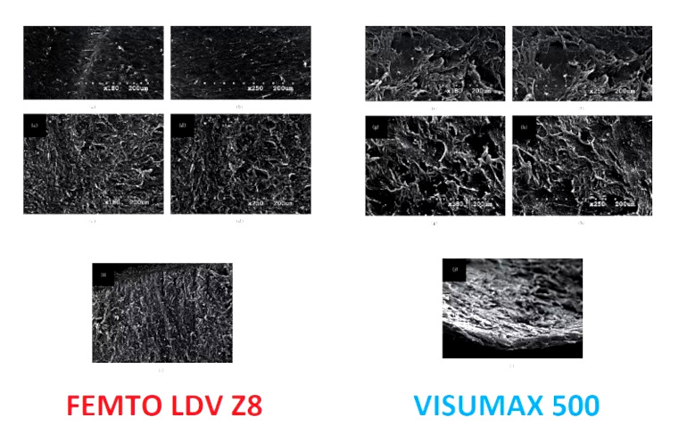 Сравнение поверхностей роговицы при воздействии лазера VisuMax 500 и Femto LDV Z8