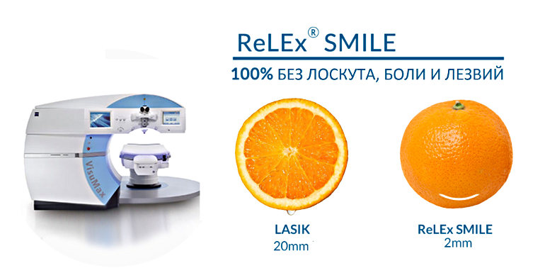 Лазерная коррекция RLEx SMILE на лазере VisuMax