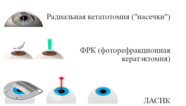 Коррекция методом фрк