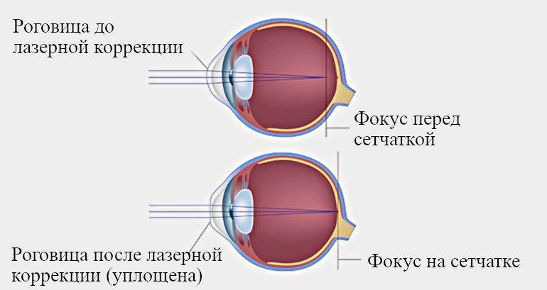 Онлайн консультация офтальмолога