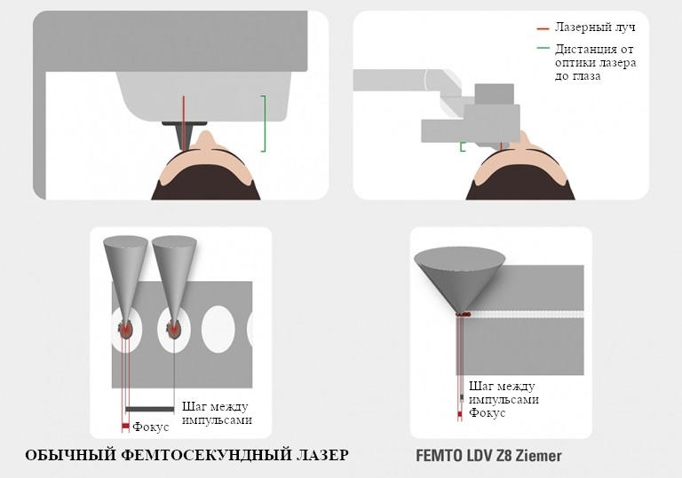 Концепция низкой энергии при коррекции CLEAR на лазере FEMTO LDV Z8